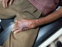 Digigit Kobra Saat Membabat Rumput, Warga Karang Intan Meregang Nyawa