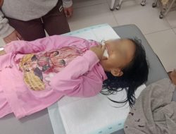 Benang Layang-layang Lukai Bibir Bocah