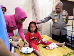 Asa Baru untuk Adel dan Jailani, Kapolda Kalsel Tanggung Operasi Kakak Beradik Yatim Piatu Korban Kecelakaan Maut