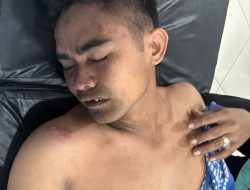 Tolak Kasih Uang Beli Miras Juru Parkir Ditikam, Polisi: Pelaku Sudah Diamankan!