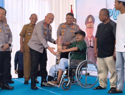 Aspihani Bersyukur Bisa Melangkah Kembali, 7.414 Warga Terlayani Bakti Kesehatan Polda Kalsel
